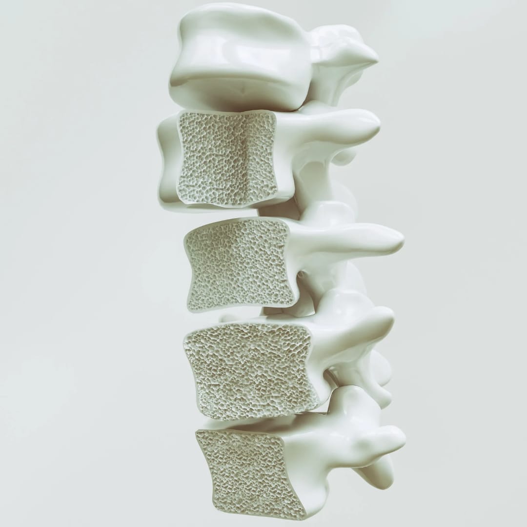 Osteoporosis Treatment in Bengaluru- Facts by Dr. Akshay Shetty