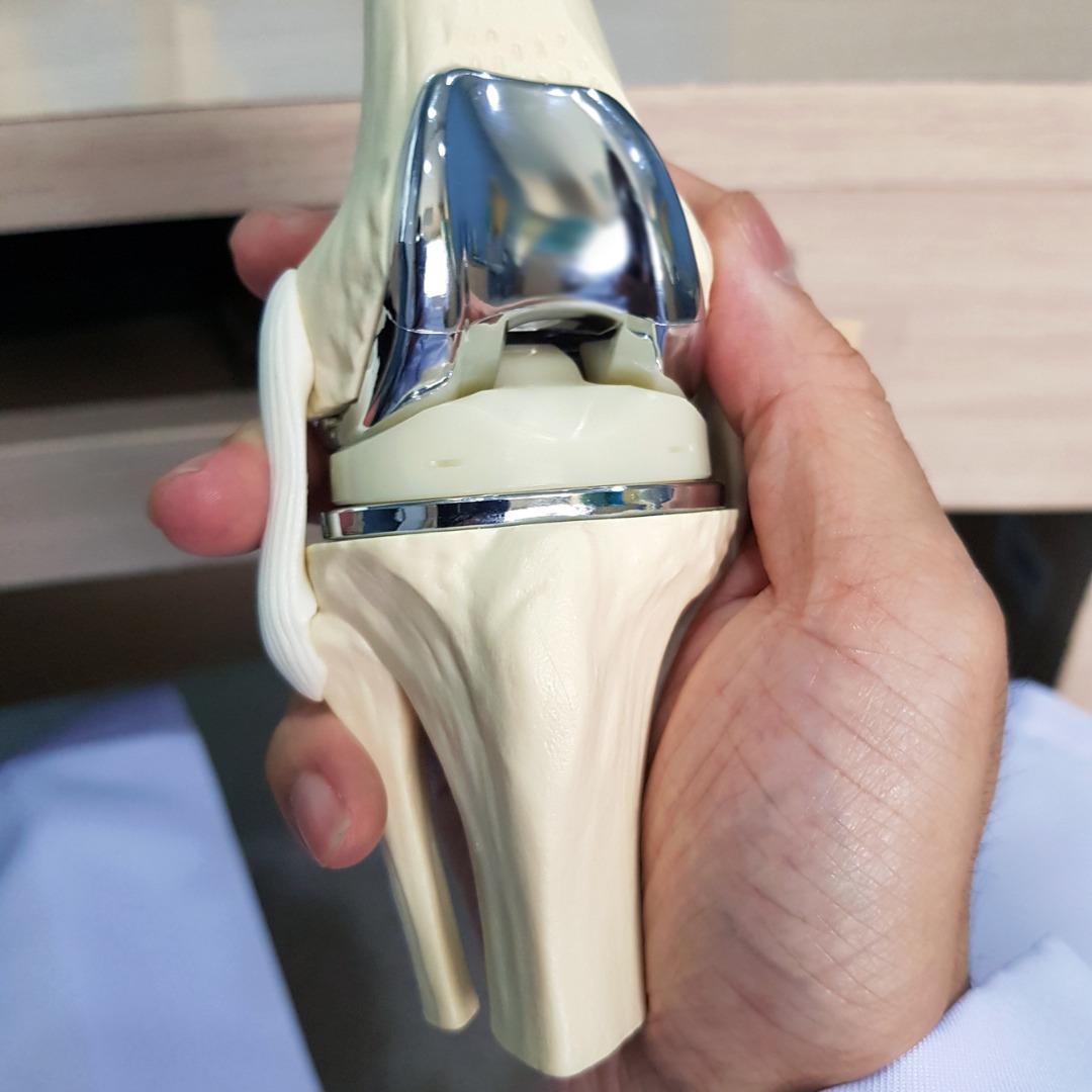 Knee Replacement or Knee Preservation