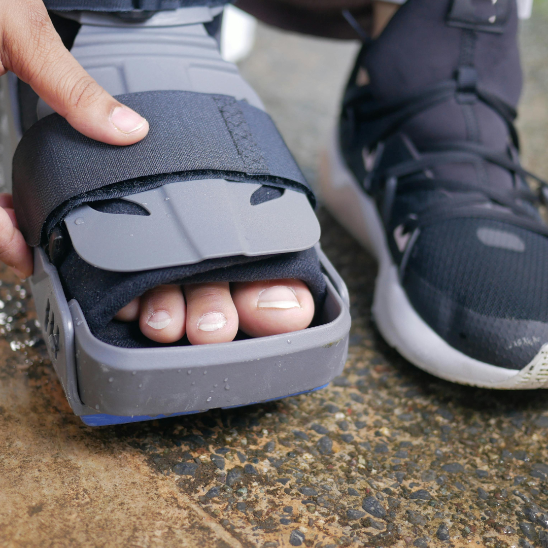 Best Orthopedic for Fracture Care and Trauma Management in Bangalore