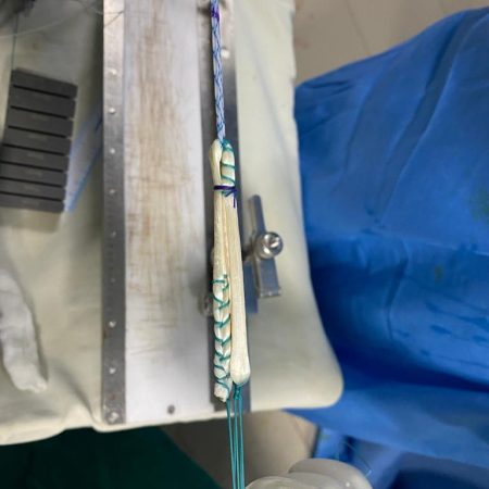 Ligament Reconstruction in HSR layout